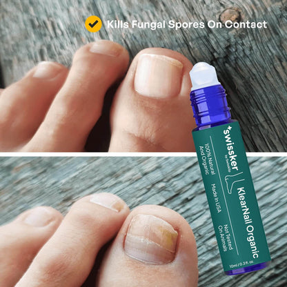 KlearNail Mantar Önleyici Çubuk